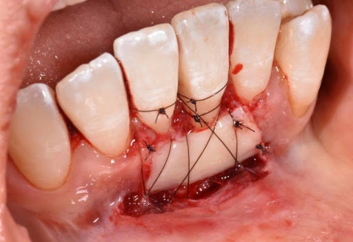 Smile Care Consultorio Dental - Thumbnail