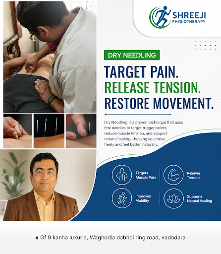 Shreeji Physiotherapy offers expert dry needling and specialized physiotherapy services including… post image