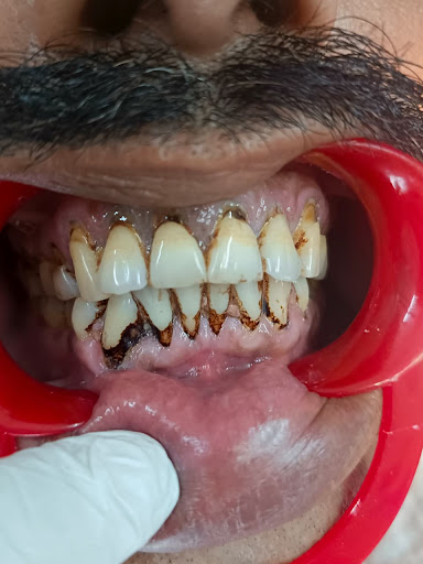 Best dentist near me in Jaipur? post image