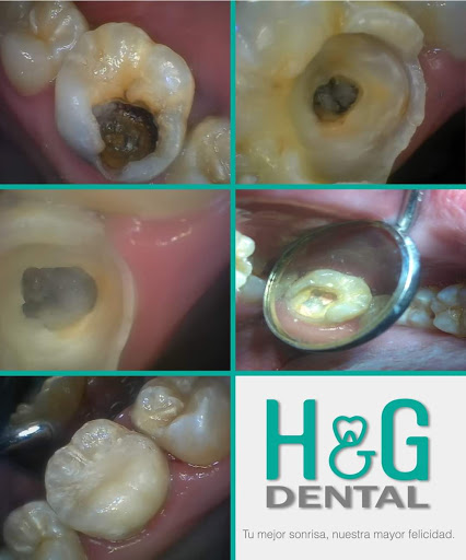 H&G Dental - Thumbnail