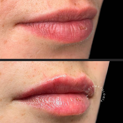 Opinii despre vsdermatologia/ Dr. Juan Pablo Valdivieso-Dra. Mercedes Solis Ramirez în Cuenca - Dermatólogo