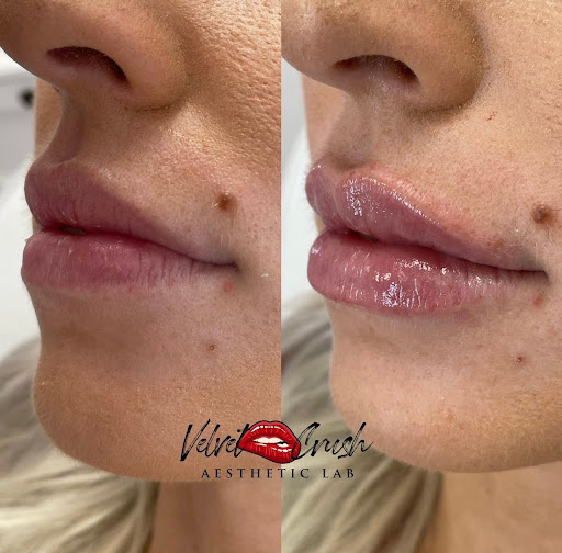 Velvet Crush Aesthetic Lab