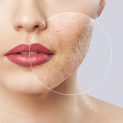 Derick Dermatology - Elgin