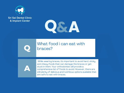 Curious about what foods to enjoy with braces?  post image