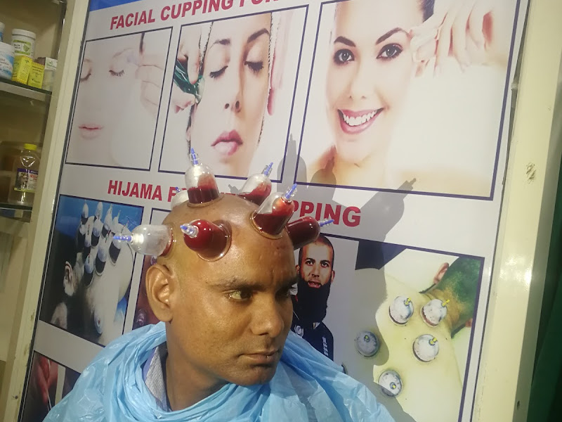 Hijama Session Highlight
