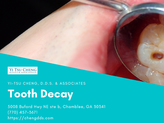 Yi-Tsu Cheng, D.D.S. & Associates is a Leading Provider of Root Canal Procedures in Chamblee, Georgia