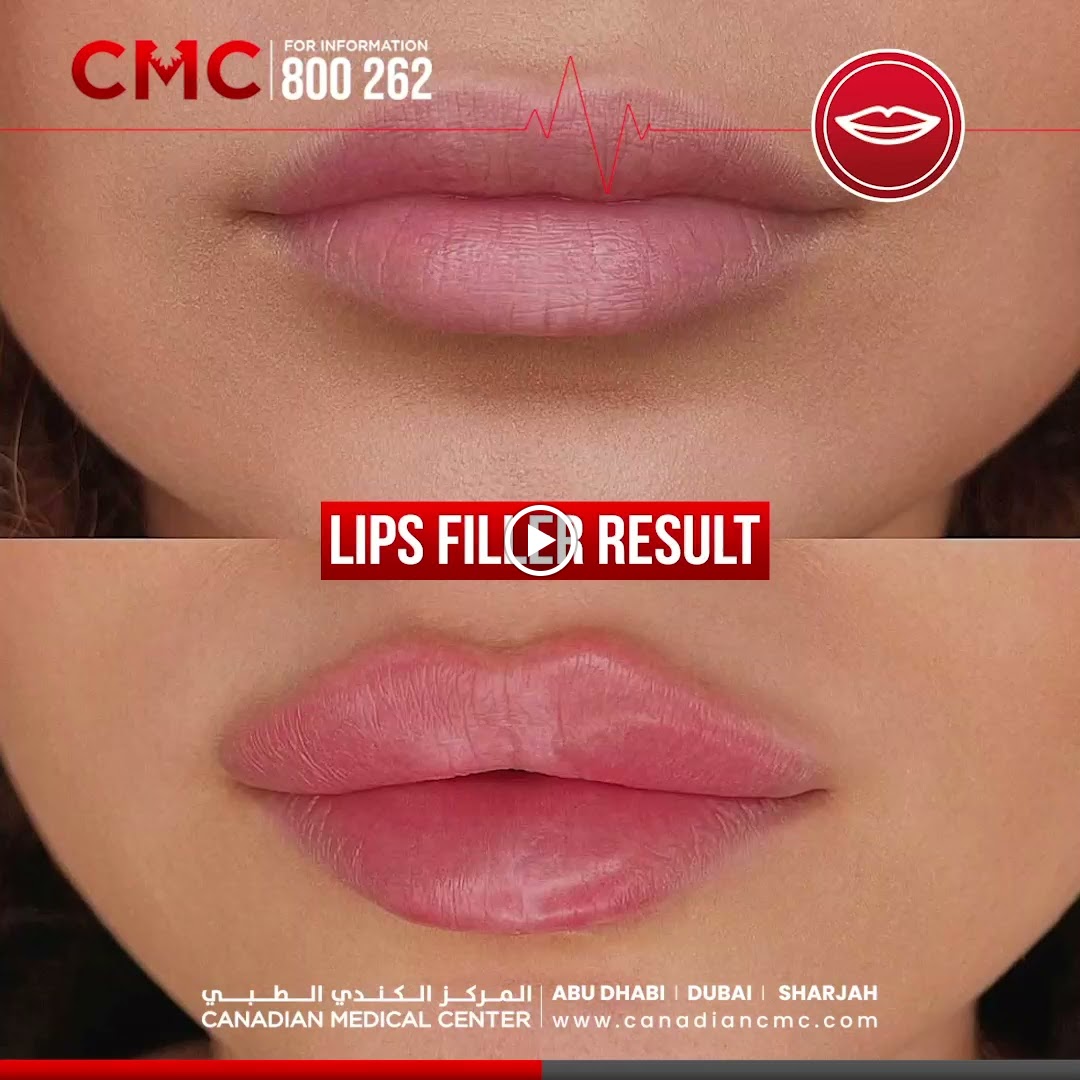 Canadian Medical & Rehabilitation Center CMC - صورة 3