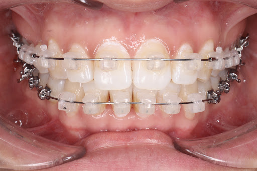 LIHE, Dentista Monterrey - Thumbnail