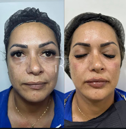 Dra Raiana Felipe - Harmonização Orofacial