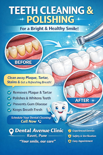 Teeth Cleaning and Polishing post image