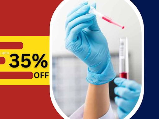 UPTO 35% DISCOUNT post image