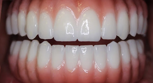 Implants4Life - Visual