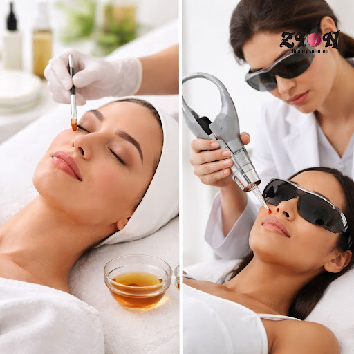 Confused between chemical peels and laser treatment for dark spots, tanning or uneven skin tone?… post image