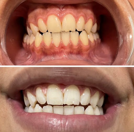 Smile Labs of Broome County