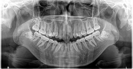 Dental ZAS odontología y ortodoncia Dra. Anahi