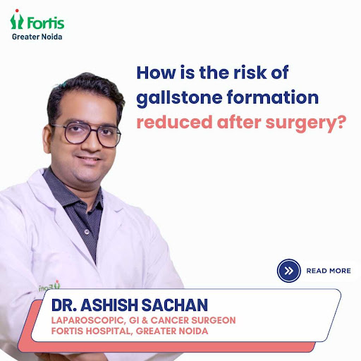 After gallbladder surgery (cholecystectomy), the risk of gallstone formation is significantly red… post image