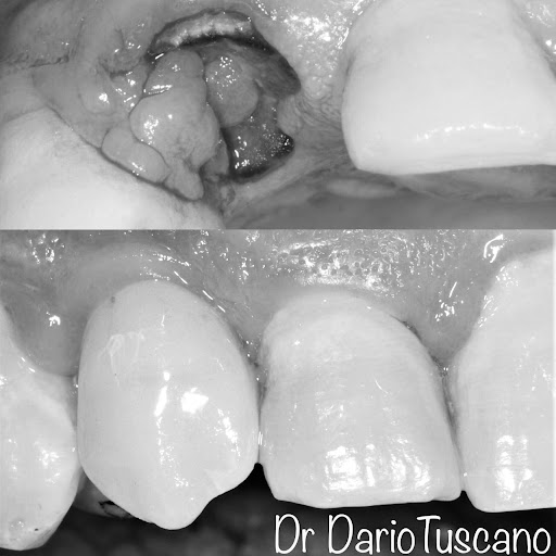 Studio Dentistico Bio Dental Core di Dr. Dario Tuscano - Thumbnail