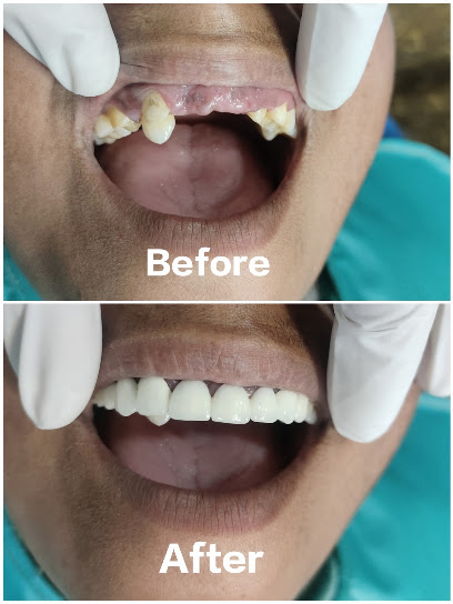 SAI GANESH DENTAL CLINIC