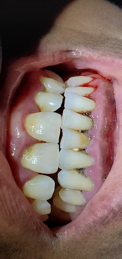 Coronado Clinica Dental - Thumbnail