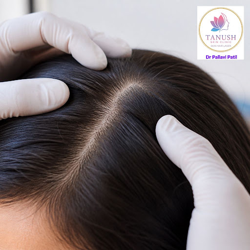 Healthy, strong hair starts with a healthy scalp. At Tanush Skin & Hair Clinic in Bhiwandi, we fo… post image