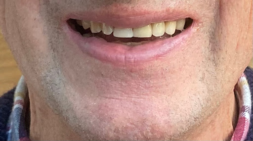 Walford Mill Dental Care Limited - Thumbnail