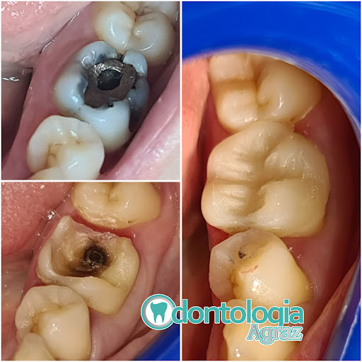 ODONTOLOGIA AGRAZ - Thumbnail