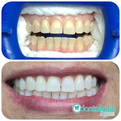 ODONTOLOGIA AGRAZ - Thumbnail