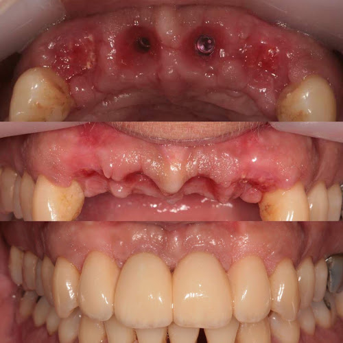 Comentarii opinii despre Ιατρείο Περιοδοντολογίας& Εμφυτευμάτων ΓΕΩΡΓΙΟΣ Α. ΜΕΛΙΣΣΑΡΗΣ