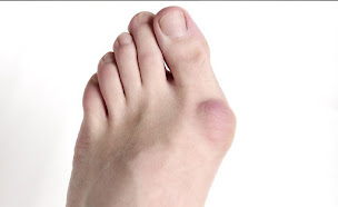 Photo n°2 de Dr DJIAN Michael à Antibes (Chirurgien orthopédiste)