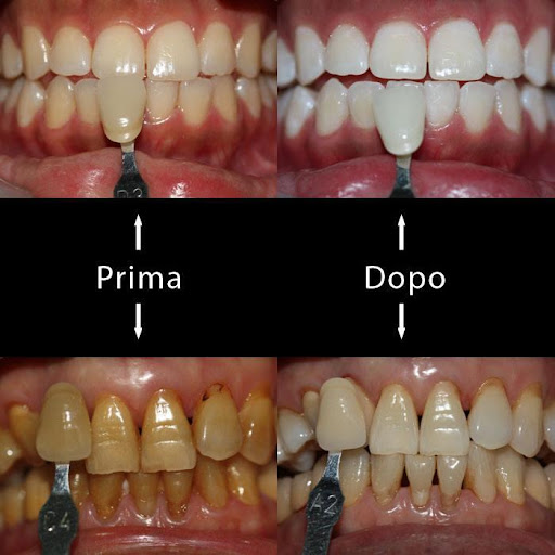 Studio Dentistico Zuccarino dott. Stefano - Thumbnail
