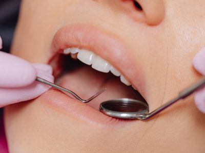 Need reliable dental care in Pimpri-Chinchwad and searching for a trusted clinic? DR. PATIL'S DEN… post image
