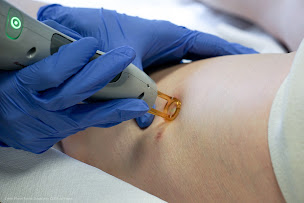 Photo n°9 de Clinique Laser Esthétique Médicale à Vannes (Centre d'épilation laser)