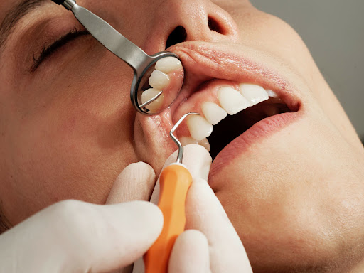 The OC Smiles Family Dental