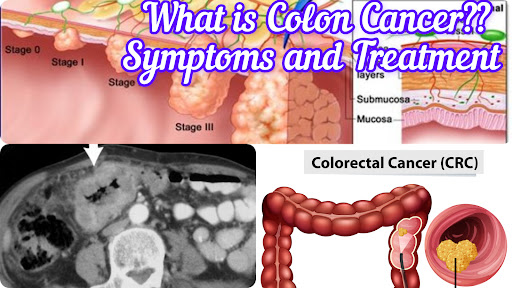 Gallery image 210