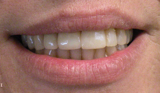 Marshall A. Polan DDS