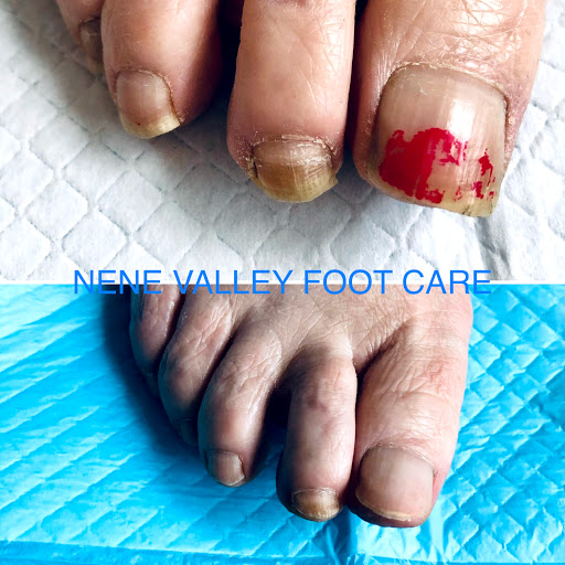 Nene Valley Foot Care - Thumbnail