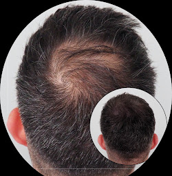 Photo n°5 de Atypique à stella (Tatoueur)