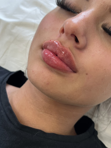 Kamaya Beauty, Aesthetics & Academy - Lip Fillers Batley - Thumbnail