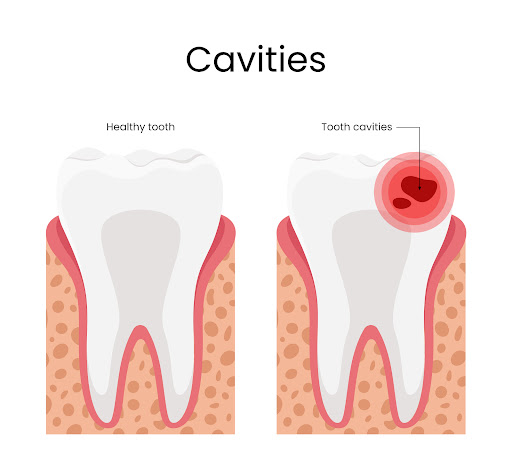 At Happy Tooth Dental Care and Diagnostic Centre, we specialize in the prevention and treatment o…
