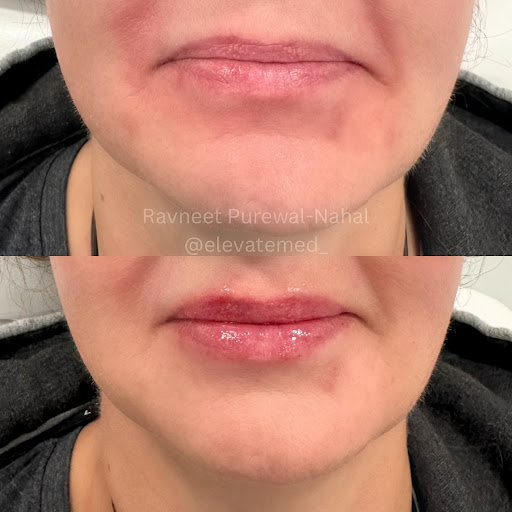 Elevate Medical Center