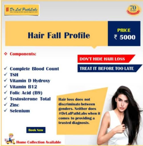 HAIR FALL PROFILE post image