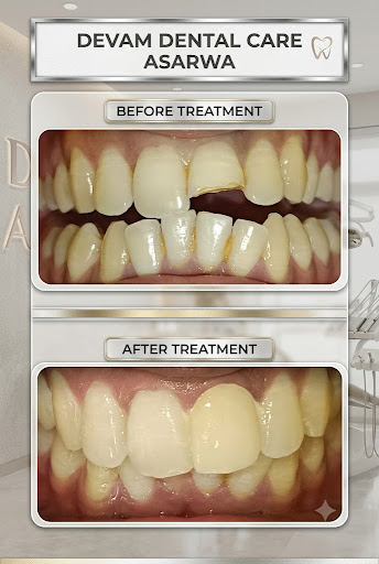 There’s nothing we love more than seeing our patients leave with a huge, confident smile! 😁 Take… post image