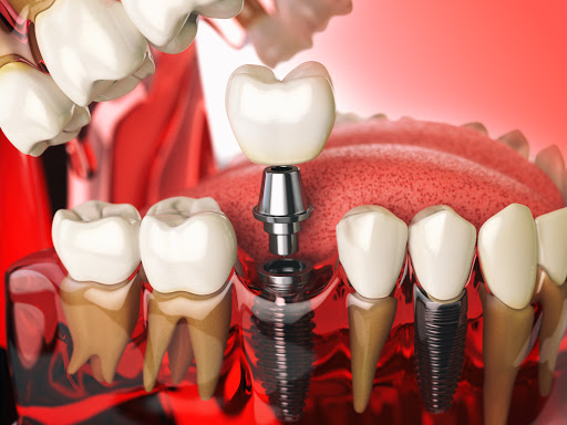 Smilee Dental Centre - Thumbnail