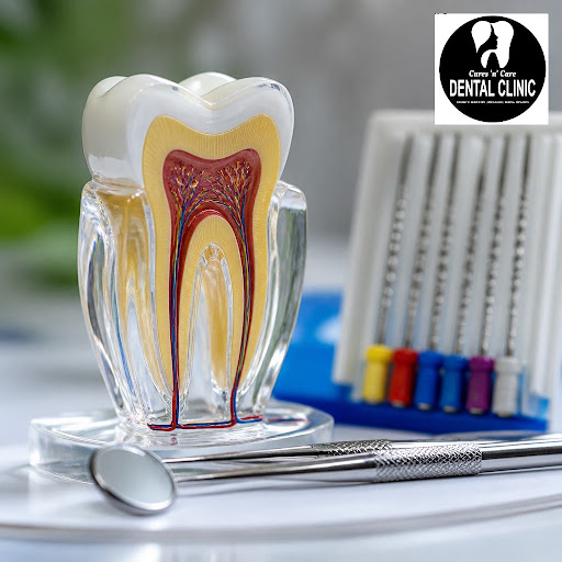 Worried you might need a root canal? At Cures 'n' Care Dental Clinic in Vasundhara, Ghaziabad, we… post image