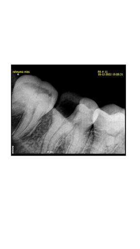 Digital X-ray in Just ₹150 only post image