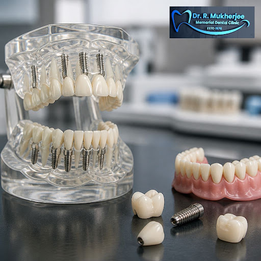 Regain a confident smile and strong bite with full mouth rehabilitation at Dr R Mukherjee Memoria… post image