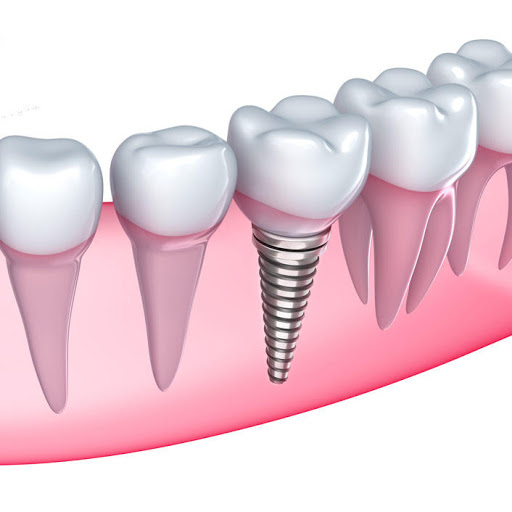 Beverly Smiles Family Dental - Thumbnail