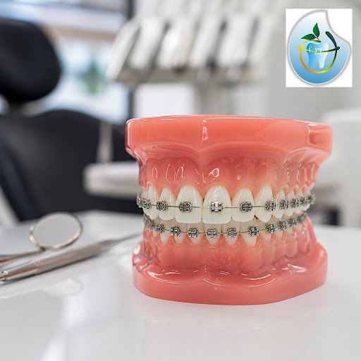 Dreaming of a straighter smile without long, painful treatments? At Fresh Smile Multispeciality D…