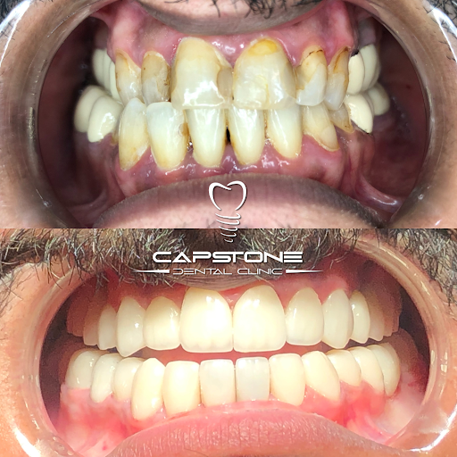 CAPSTONE DENTAL CLINIC - صورة 2