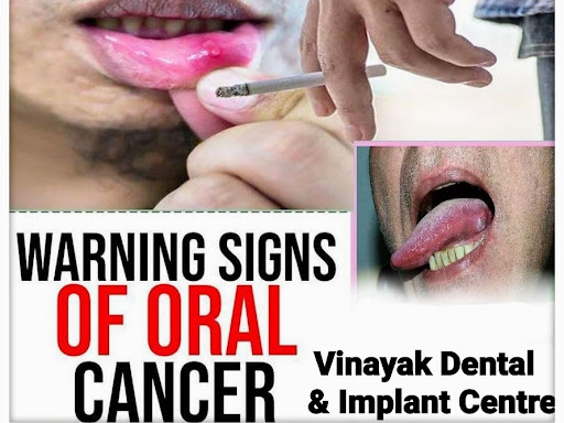 Please do not take tobacco in any form.